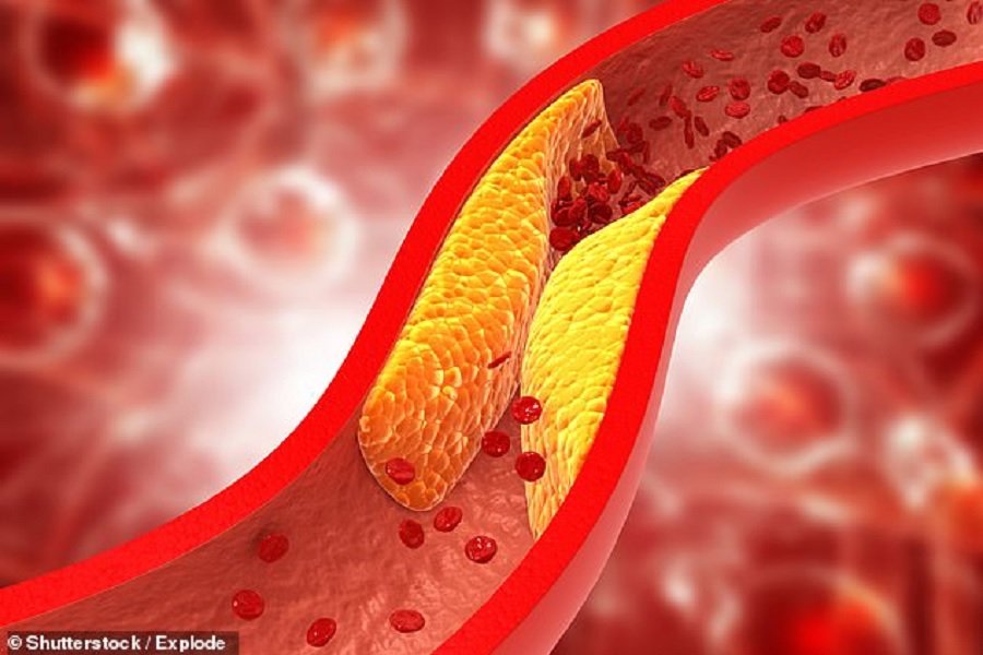 "Promising" vaccine for lowering cholesterol is discovered