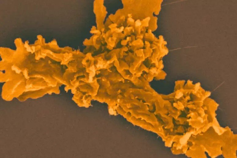 Scientists discover amoeba that survives where most life cannot